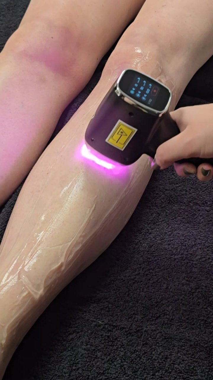 De laser op een onderbeen, met gel en roze licht